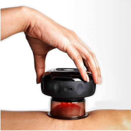 MASAJEADOR SMART CUPPING